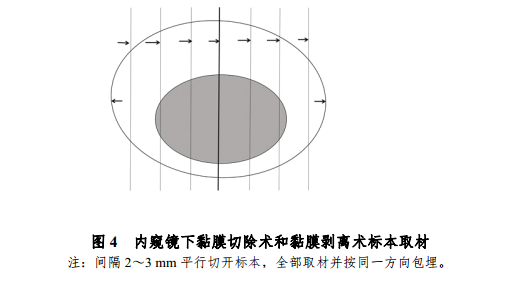 什么是放疗定位膜中国结直肠癌诊疗规范（2020）_https://www.jmylbn.com_新闻资讯_第10张