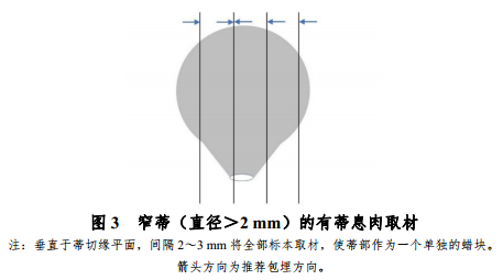 什么是放疗定位膜中国结直肠癌诊疗规范（2020）_https://www.jmylbn.com_新闻资讯_第9张
