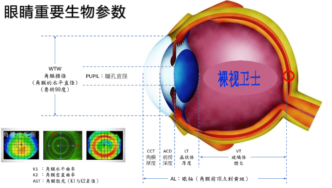 怎么测角膜直径【原创】生物测量参数︱屈光参数的详解_https://www.jmylbn.com_新闻资讯_第3张