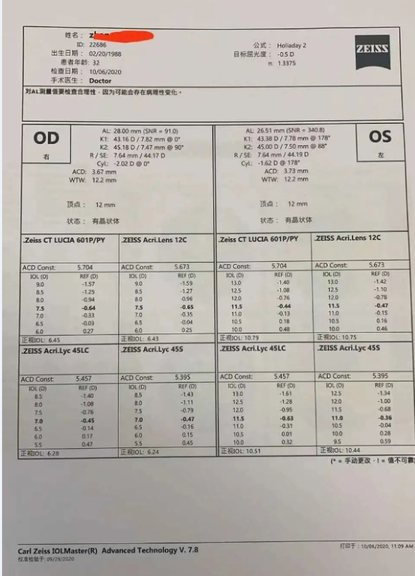怎么测角膜直径【原创】生物测量参数︱屈光参数的详解_https://www.jmylbn.com_新闻资讯_第12张