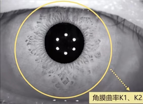 怎么测角膜直径【原创】生物测量参数︱屈光参数的详解_https://www.jmylbn.com_新闻资讯_第10张