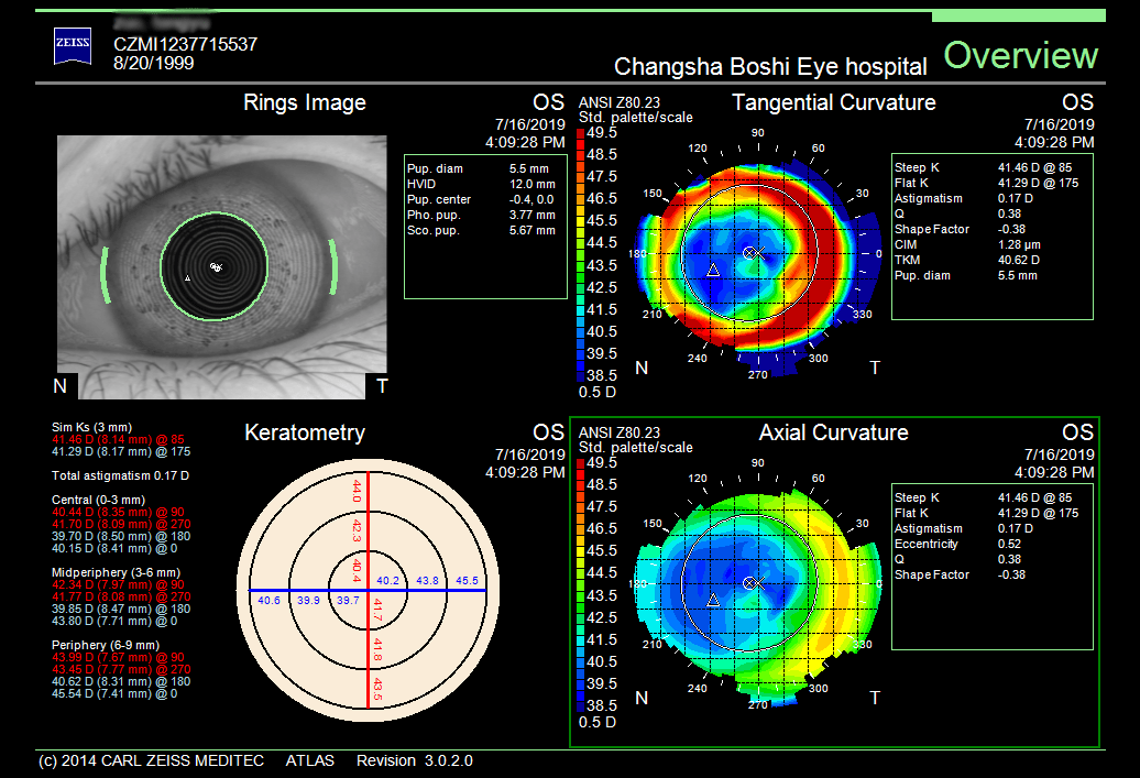 怎么测角膜直径【原创】生物测量参数︱屈光参数的详解_https://www.jmylbn.com_新闻资讯_第11张