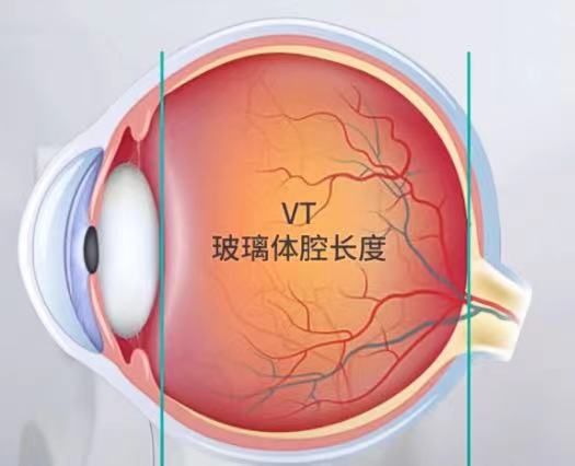 怎么测角膜直径【原创】生物测量参数︱屈光参数的详解_https://www.jmylbn.com_新闻资讯_第16张