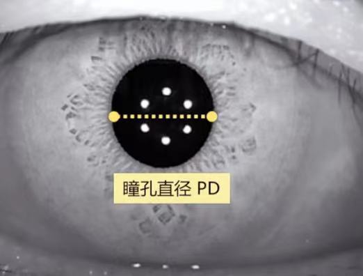 怎么测角膜直径【原创】生物测量参数︱屈光参数的详解_https://www.jmylbn.com_新闻资讯_第18张