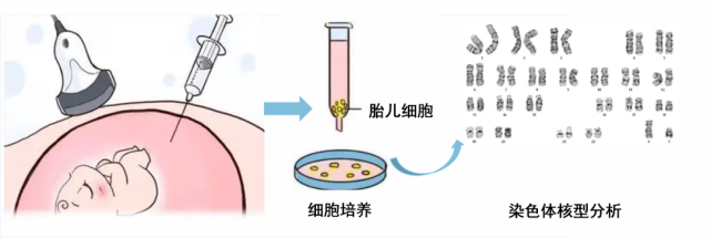 为什么用高流量呼吸经鼻高流量氧疗—让呼吸更自由_https://www.jmylbn.com_新闻资讯_第18张