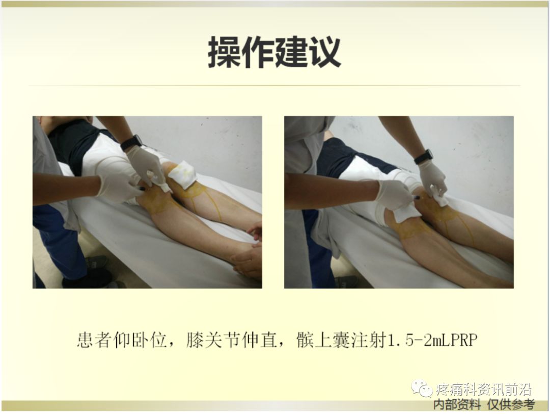 冲洗针怎么用视频膝关节冲洗技术操作视频_https://www.jmylbn.com_新闻资讯_第7张