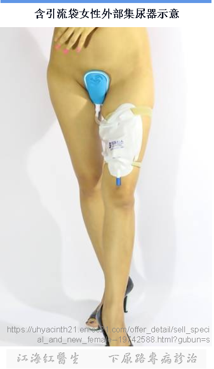 导尿包有哪些型号尿失禁用品与装备：引流袋_https://www.jmylbn.com_新闻资讯_第2张