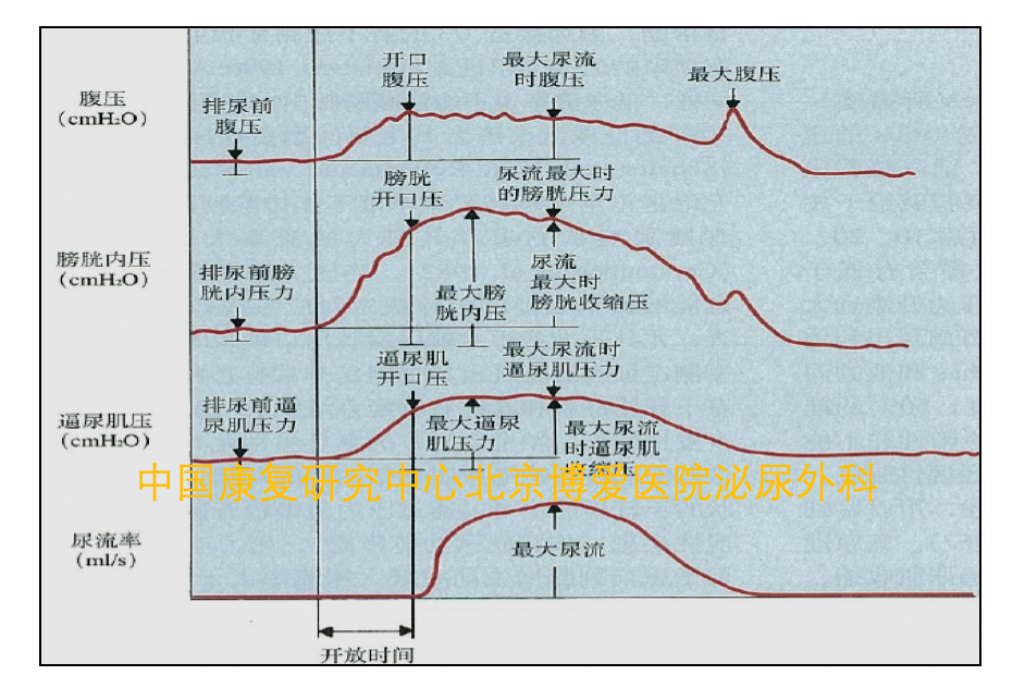 尿動力學基礎(三)_醫學界-助力醫生臨床決策和職業成長