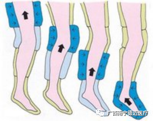 抗栓泵怎么用空气波压力治疗仪使用护理常规_https://www.jmylbn.com_新闻资讯_第2张