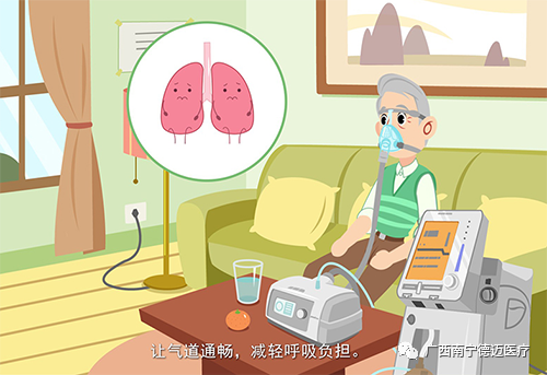 呼吸机怎么选干货 ｜ 如何正确选择合适的家用呼吸机？_https://www.jmylbn.com_新闻资讯_第8张