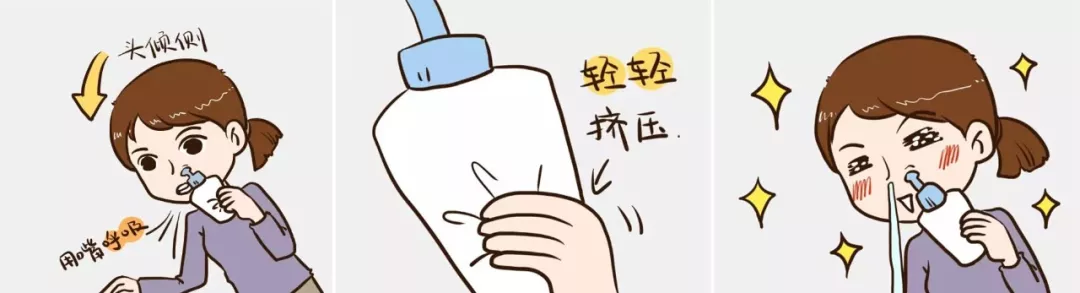 等渗冲洗液怎么用洗鼻的百科全说｜洗鼻子后头疼，是脑子进水了？_https://www.jmylbn.com_新闻资讯_第4张