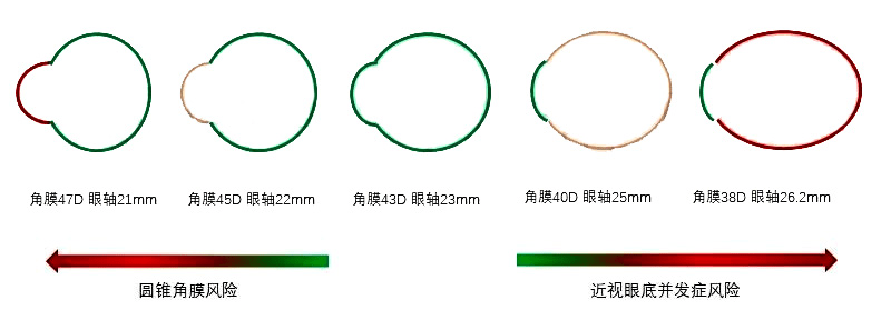 眼科生物测量仪怎么看认识眼生物测量仪_https://www.jmylbn.com_新闻资讯_第5张