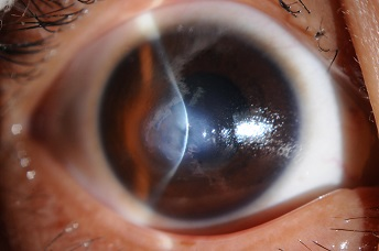 裂隙灯上光源是什么【视光之窗】221期：裂隙灯：被忽视的＂眼表守护神＂_https://www.jmylbn.com_新闻资讯_第9张