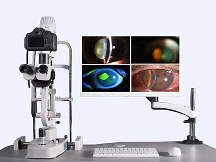 裂隙灯上光源是什么【视光之窗】221期：裂隙灯：被忽视的＂眼表守护神＂_https://www.jmylbn.com_新闻资讯_第4张