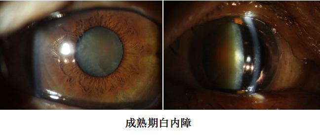 裂隙灯上光源是什么【视光之窗】221期：裂隙灯：被忽视的＂眼表守护神＂_https://www.jmylbn.com_新闻资讯_第6张