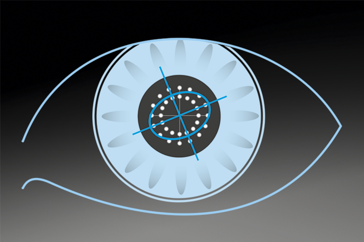 眼科生物测量仪怎么看眼生物测量仪数据解析_https://www.jmylbn.com_新闻资讯_第3张