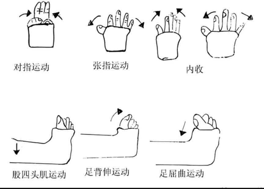 医用夹板怎么软化高分子夹板外固定后出院该注意些什么？_https://www.jmylbn.com_新闻资讯_第10张
