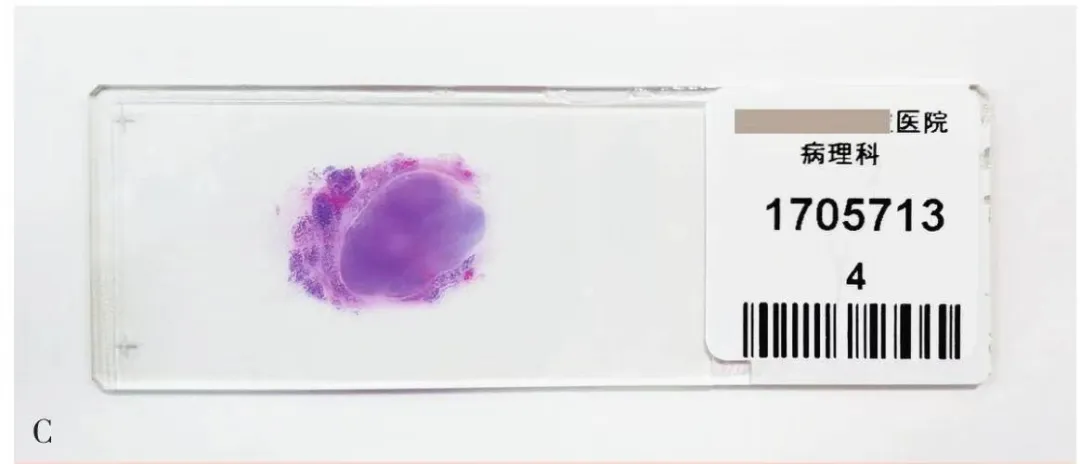 什么是病理蜡块医生让我借个病理切片？白片、HE切片、免疫组化切片、蜡块都是啥？_https://www.jmylbn.com_新闻资讯_第8张