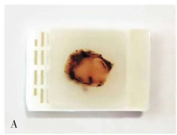 什么是病理蜡块医生让我借个病理切片？白片、HE切片、免疫组化切片、蜡块都是啥？_https://www.jmylbn.com_新闻资讯_第6张