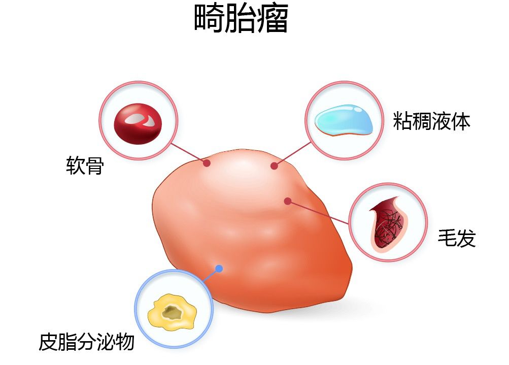 19歲少女肚子一天天隆起！檢查結果讓她慌了，醫生：立即手術！ 健康 第3張