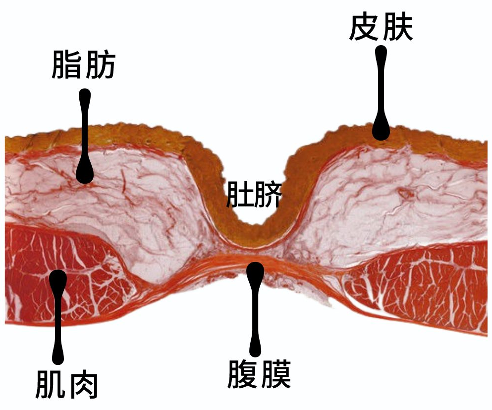 为什么剪脐带要先夹住为啥肚脐眼有凹有凸？真和医生剪脐带手法有关？事情没这么简单_https://www.jmylbn.com_新闻资讯_第13张