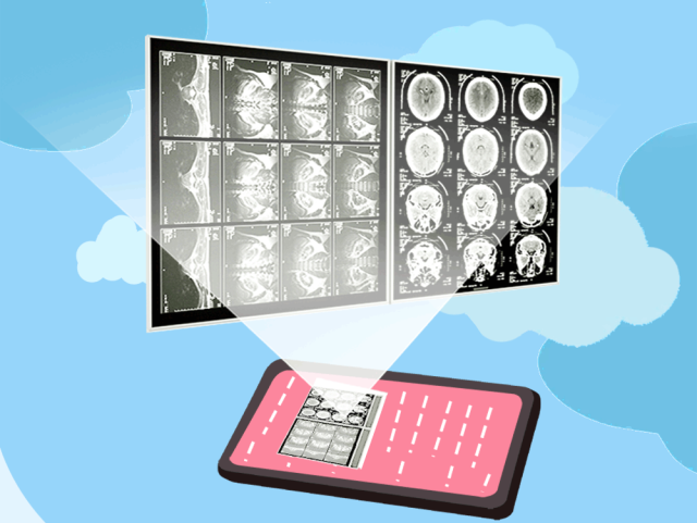 医用胶片怎么看“云胶片”服务开通！手机扫一扫，随时随地查看医学影像和诊断报告_https://www.jmylbn.com_新闻资讯_第2张