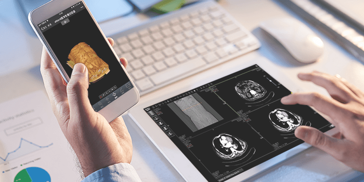 医用胶片怎么看“云胶片”服务开通！手机扫一扫，随时随地查看医学影像和诊断报告_https://www.jmylbn.com_新闻资讯_第4张