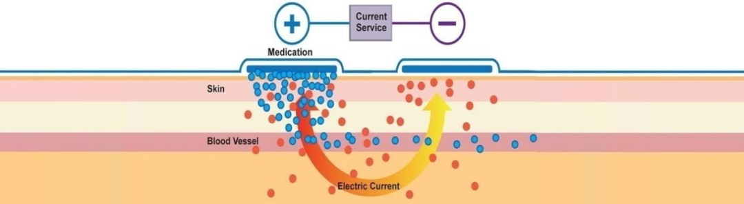 中医定向透药治疗什么了解下“中医定向透药疗法”适用于临床多种疾病_https://www.jmylbn.com_新闻资讯_第1张