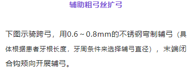正畸临床病例——“横向先行”扩弓的方法与技巧