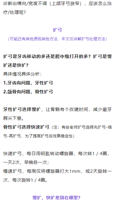 正畸临床病例——“横向先行”扩弓的方法与技巧
