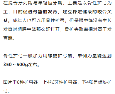正畸临床病例——“横向先行”扩弓的方法与技巧