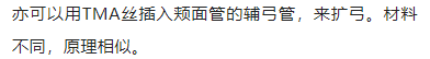 正畸临床病例——“横向先行”扩弓的方法与技巧
