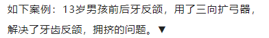 正畸临床病例——“横向先行”扩弓的方法与技巧