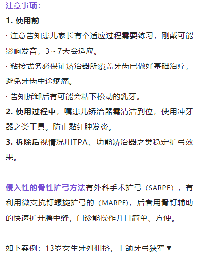 正畸临床病例——“横向先行”扩弓的方法与技巧