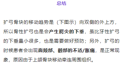 正畸临床病例——“横向先行”扩弓的方法与技巧