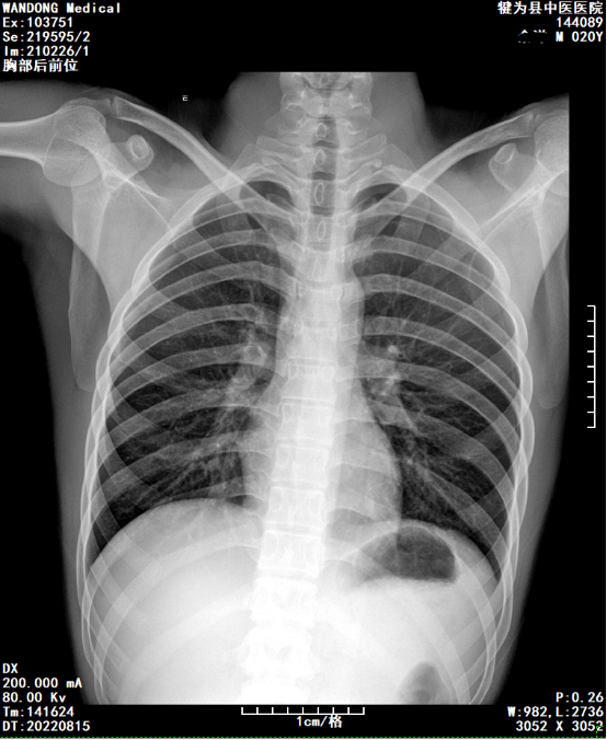 DR胶片为什么分尺寸【影像科普】教你识别影像胶片的四角信息_https://www.jmylbn.com_新闻资讯_第2张