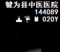 DR胶片为什么分尺寸【影像科普】教你识别影像胶片的四角信息_https://www.jmylbn.com_新闻资讯_第3张