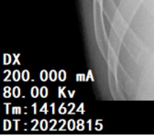DR胶片为什么分尺寸【影像科普】教你识别影像胶片的四角信息_https://www.jmylbn.com_新闻资讯_第5张
