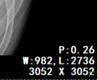 DR胶片为什么分尺寸【影像科普】教你识别影像胶片的四角信息_https://www.jmylbn.com_新闻资讯_第6张