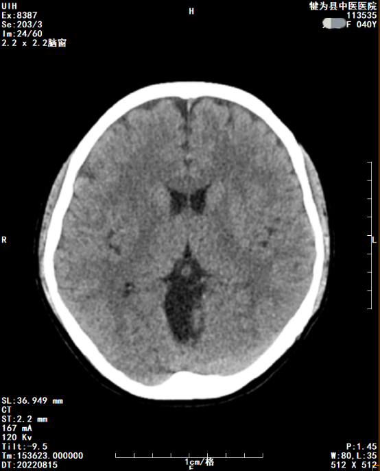 DR胶片为什么分尺寸【影像科普】教你识别影像胶片的四角信息_https://www.jmylbn.com_新闻资讯_第7张