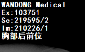 DR胶片为什么分尺寸【影像科普】教你识别影像胶片的四角信息_https://www.jmylbn.com_新闻资讯_第4张