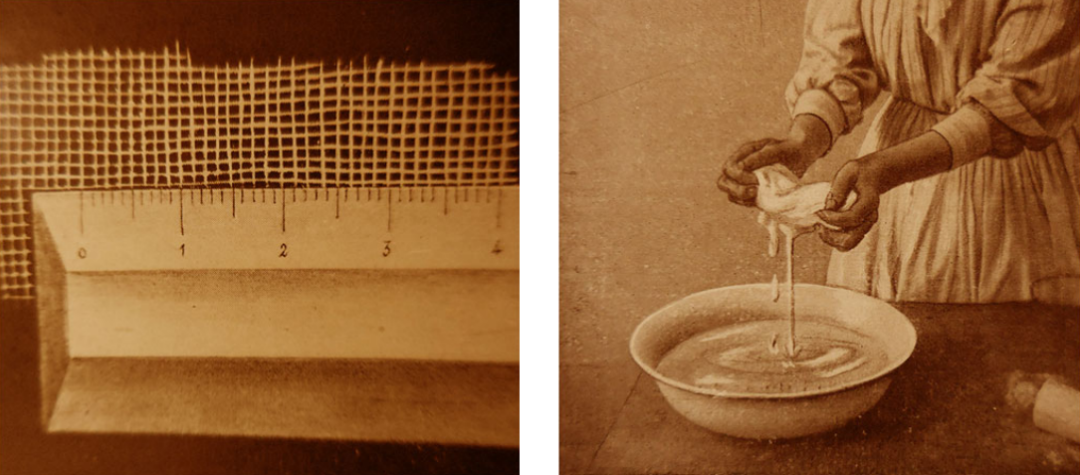 绷带石膏怎么拆除石膏绷带：300年矫形外科遗产_https://www.jmylbn.com_新闻资讯_第8张