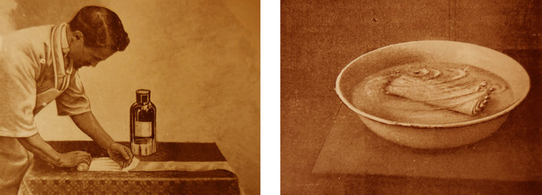 绷带石膏怎么拆除石膏绷带：300年矫形外科遗产_https://www.jmylbn.com_新闻资讯_第7张