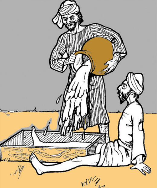 绷带石膏怎么拆除石膏绷带：300年矫形外科遗产_https://www.jmylbn.com_新闻资讯_第1张