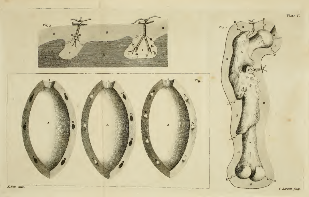 绷带石膏怎么拆除石膏绷带：300年矫形外科遗产_https://www.jmylbn.com_新闻资讯_第3张