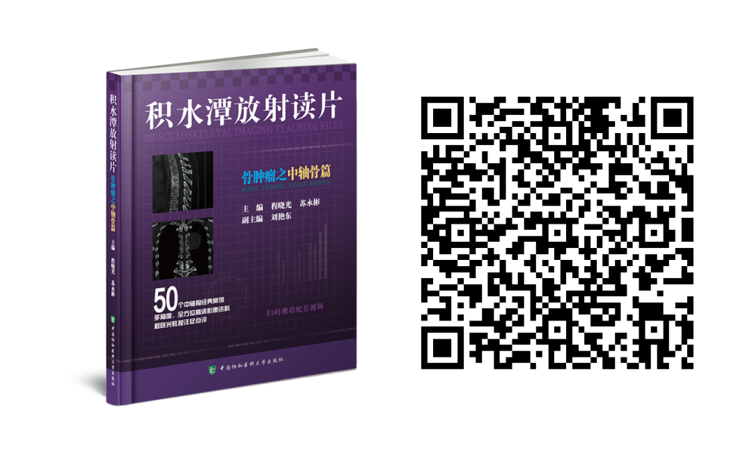 医用头灯国外怎么买最新骨科图书汇总，618大促补贴超值购_https://www.jmylbn.com_新闻资讯_第5张
