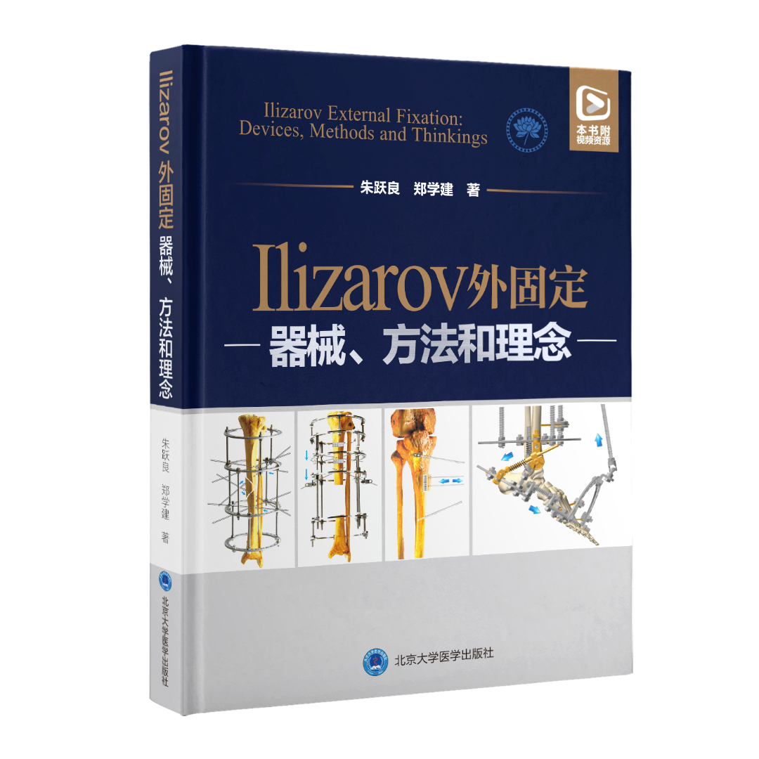 手术头灯眼镜怎么畅销书！Ilizarov 外固定：器械、方法和理念_https://www.jmylbn.com_新闻资讯_第2张