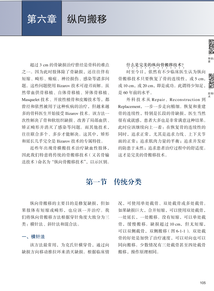 手术头灯眼镜怎么畅销书！Ilizarov 外固定：器械、方法和理念_https://www.jmylbn.com_新闻资讯_第10张