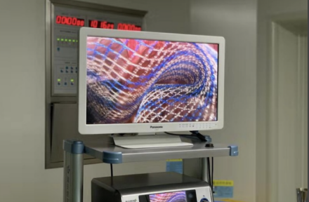 疝气补片怎么用疝外科小科普 ｜ 了解一下腹腔镜疝修补术用的“补片”吧！_https://www.jmylbn.com_新闻资讯_第2张