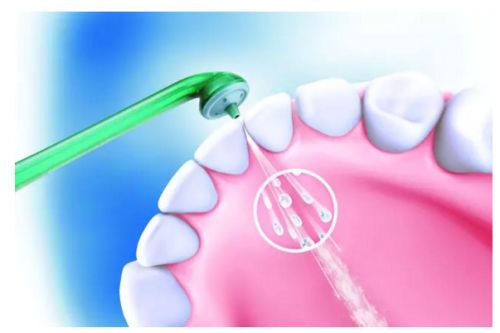 洗完牙后担心牙齿敏感？如何恢复牙齿健康原态？